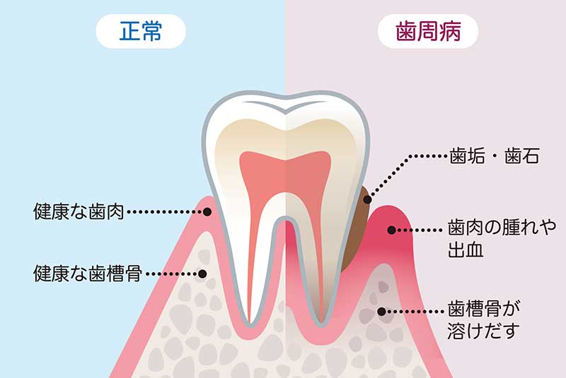 一般歯科
